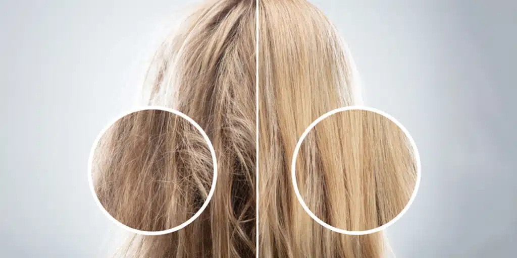 Imagem do antes e depois dos cabelos hidratados